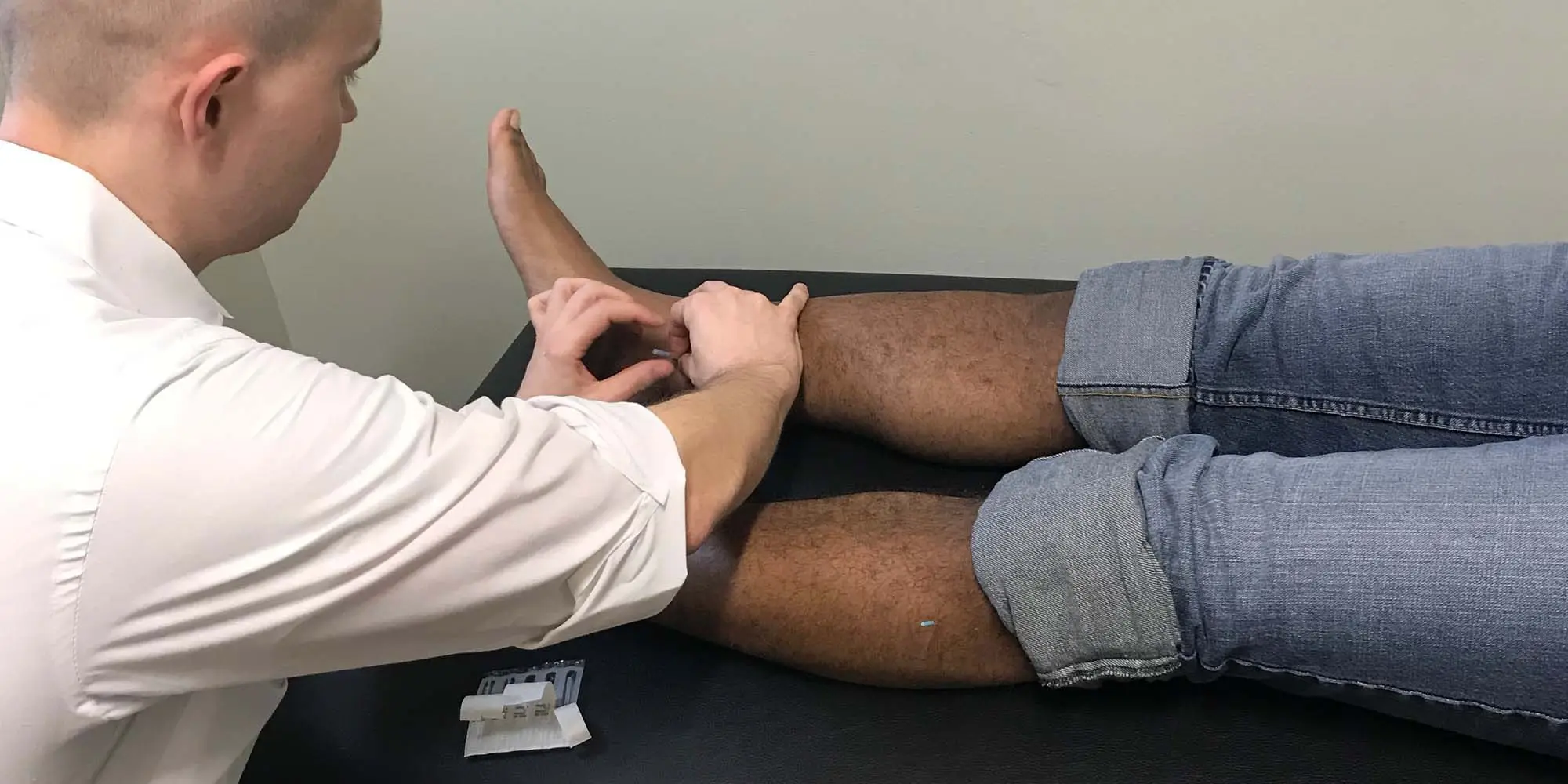 Acupuncture Greensboro NC David Huff Applying Acupuncture Acupuncture Greensboro NC David Huff Applying Acupuncture