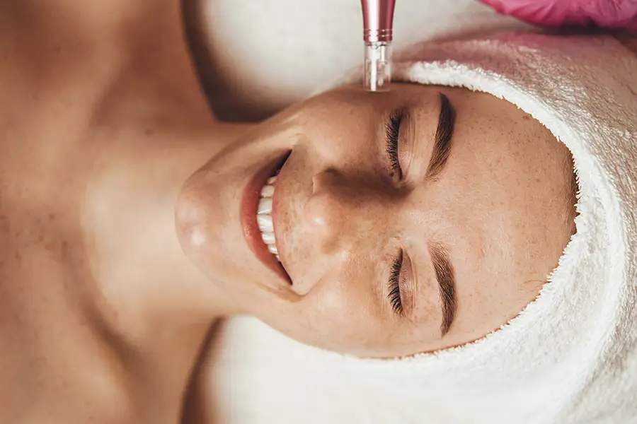 Microneedling & Cosmetic Acupuncture Greensboro NC Woman's Face