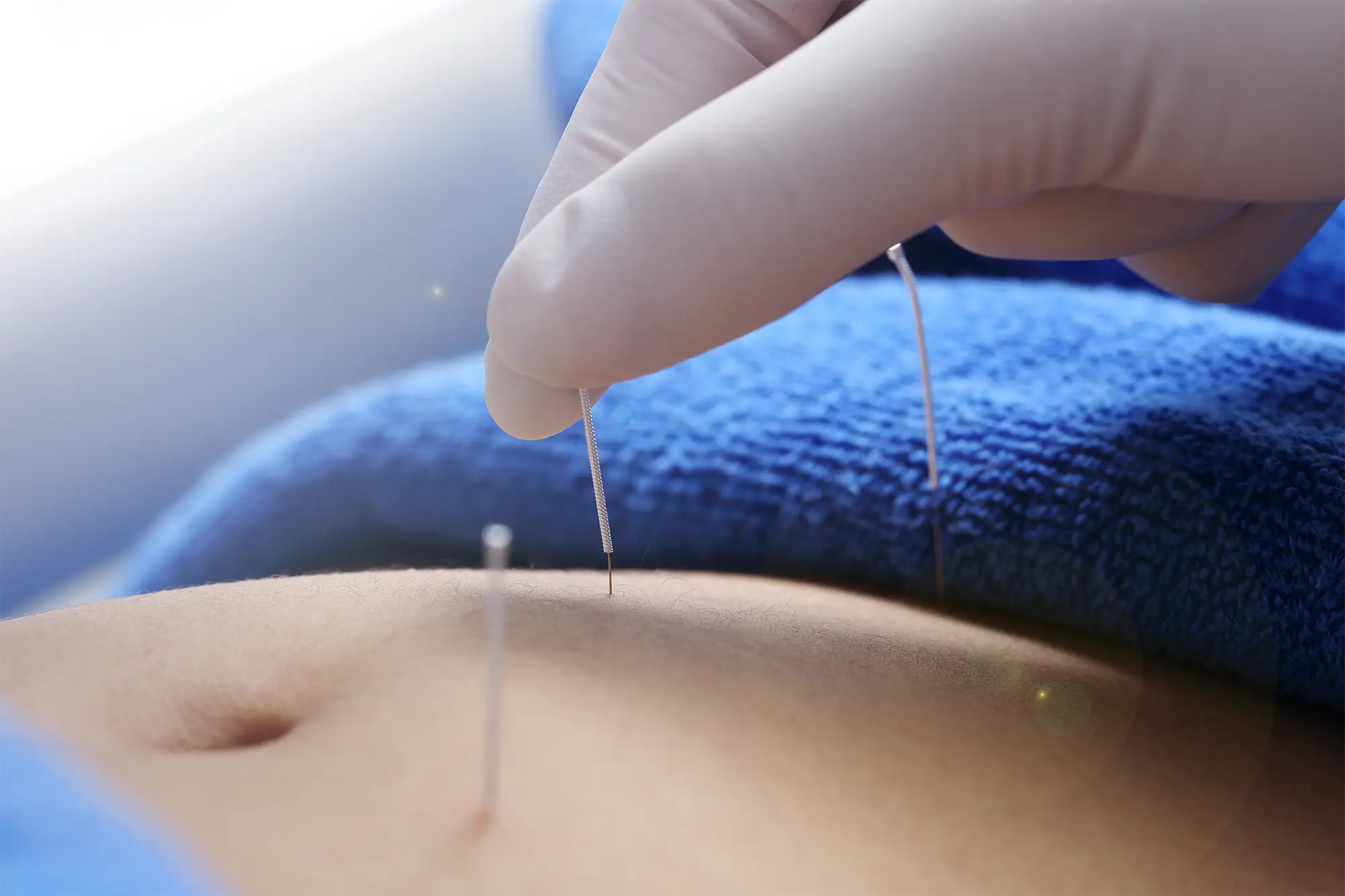 Chiropractic Greensboro NC Stomach Acupuncture Chiropractic Greensboro NC Stomach Acupuncture